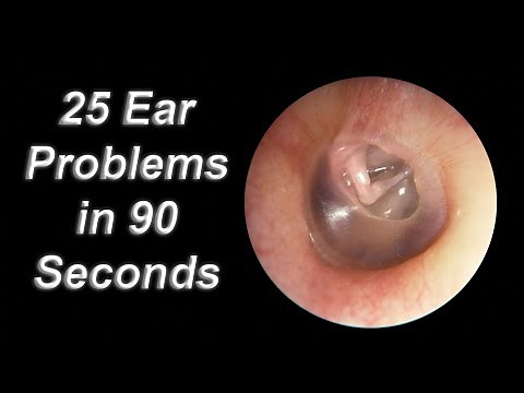 25 Ear Problems in 90 Seconds