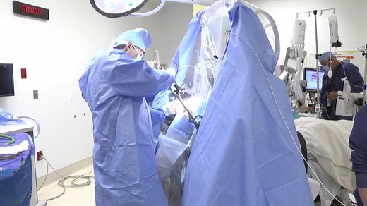 Deep Brain Stimulation Surgery (graphic)