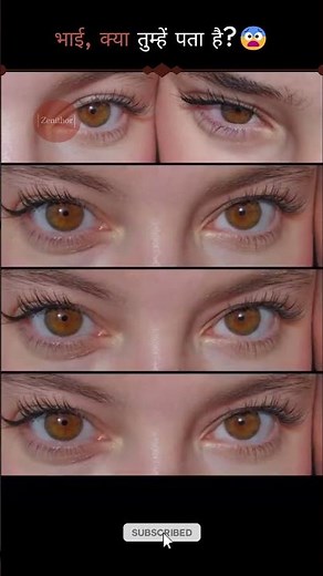 The Truth About Blue & Green Eyes 👀✨