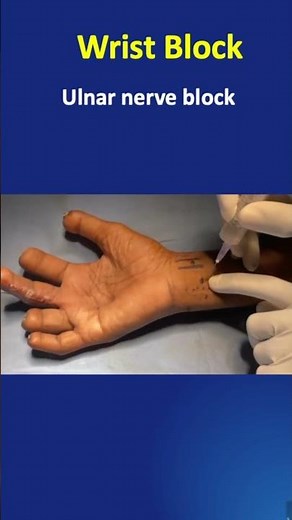 Wrist Block Technique #wristblock