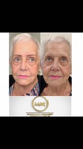 Eyebrow shading ❤️. Shading / powder brows is a cosmetic procedure...