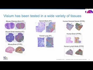10x Genomics Spatial Analysis Solutions