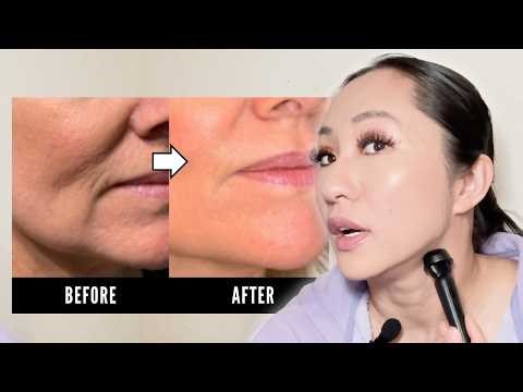 The Ultimate Guide to Jowls: Causes, Prevention, and Microneedling