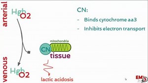 Causes and signs of cyanide toxicity