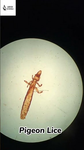 Human and Pigeon Lice | Under Microscope | LabTech Tutorial