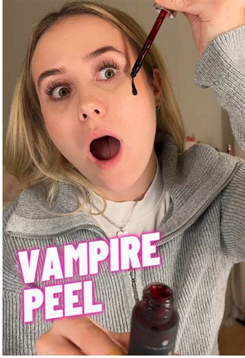 🩸 VAMPIRE PEEL 🩸 Ein intensives Fruchtsäure-Peeling für sofortigen Glow in nur 90 Sekunden ✨ Die kraftvolle Formel unterstützt die Hauterneuerung, verleiht einen frischen, ebenmäßigen Teint und lässt die Haut sichtbar glatter wirken. Bei regelmäßiger Anwendung kann das Hautbild verfeinert werden: ✨ mehr Glow ✨ ausgeglichenerer Hautton ✨ sichtbar ebenere Hautstruktur Perfekt für alle, die sich einen Instant-Glow mit Wow-Effekt wünschen 🔥 @L I S A✨ #vampirepeel #glowingskin #skincareinnovation 