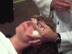 Accutome A-scan Plus Immersion Demonstration