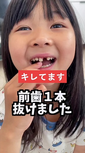 歯が抜けたらどうしてた？ちなみにパパは毎回ベランダから投げてた🥸#ゆずみつ #子供のいる暮らし #キレてます #前歯無い系女子