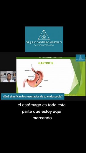 Importancia de la endoscopía en el diagnóstico gastrointestinal