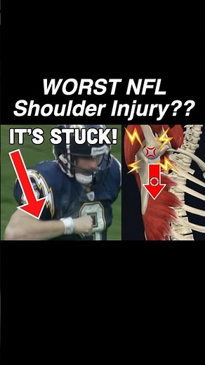 WORST NFL SHOULDER INJURY? Doctor Explains why DREW BREES can't THROW