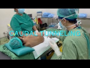 Caudal Tunelling