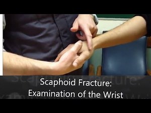 scaphoid fracture examination of the wrist (real video)