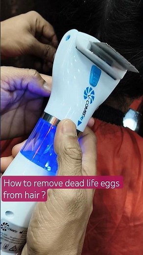 How to remove dead lice eggs from hair #hairlice