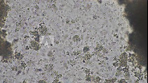 coughing, Phlegm and mucus under the microscope