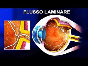 Fluorescence angiography (FAG) and indocyanine green angiography (ICGA) (www.oculisticaTV.it)