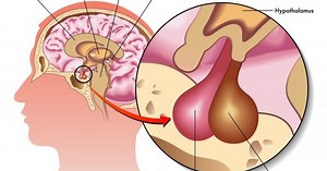 How Human Growth Hormone (HGH) is Produced