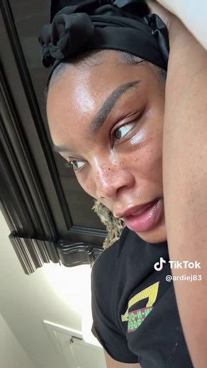 Do a quick Google search on what a midface lift is… you might be surprised 🥰