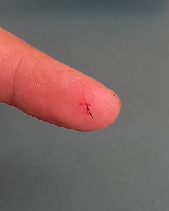 730K views · 3.8K reactions | Easy Splinter Removal Trick | Genius Craft | Facebook