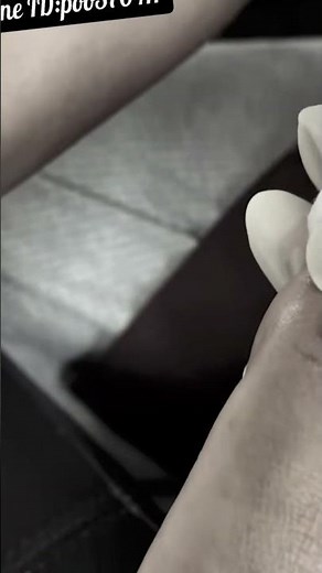 Technical is trim toenail Part 253