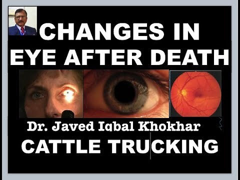 40. EYE CHAGES AFTER DEATH FIXED DILATED PUPILS TACHES NOIRES CATTLE TRUCKING OPTIC DISC