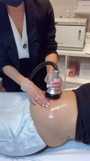 RF Body Contouring #rfbodysliming #rfbodycontouring #rfbodyscupt #rfvacuum #rfbodyshaping