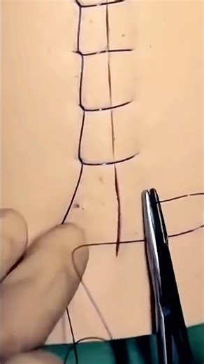 Ford Interlocking Suture 😷#goodtoknow #suturing #surgeonlife #funfacts #lifehacks #stitches #vet