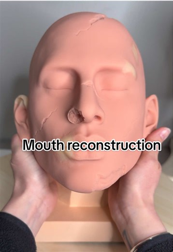 Mouth Reconstruction Techniques in Restorative Art