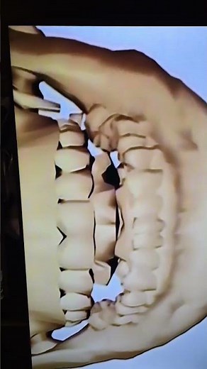 Eyewitness Skeleton 1994 Skull Close up vhs