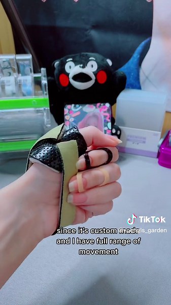 Ring Splints for Hypermobility: My Experience & FAQs