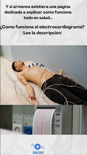 Electrocardiograma (ECG): Qué es y cómo funciona?
