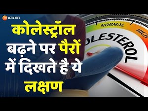 Hume Fikr Hai Aapki Live : Cholesterol बढ़ने पर पैरों में दिखते है ये लक्षण, जानें एक्सपर्ट्स से
