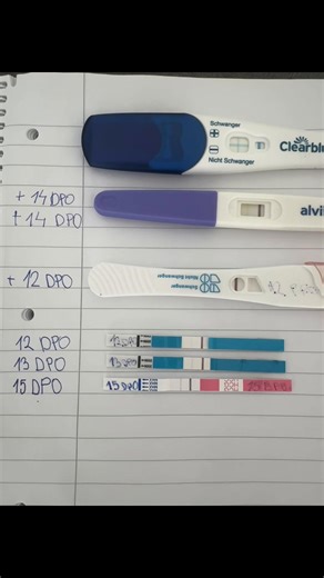 Understanding DPO Progression After Trigger Shot