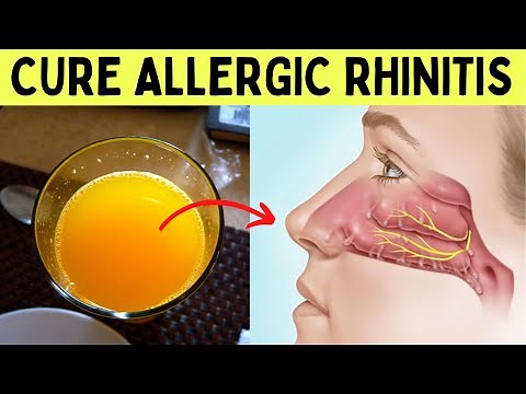 How to cure allergic rhinitis permanently naturally at home and stop allergic sneezing
