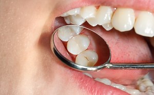 Enfermedades bucales afectan a 45% de la población mundial: OMS