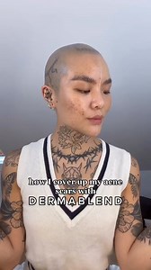5.3K views · 86 reactions | How I cover up my acne scarring with @Dermablend Professional concealer, foundation, and powder  #viralreels #viralvideo #viralpost #reelsviral #reels2024 | Coast Reports | Facebook
