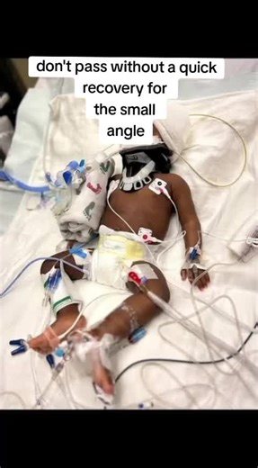 Quick Recovery Tips for Small Injuries