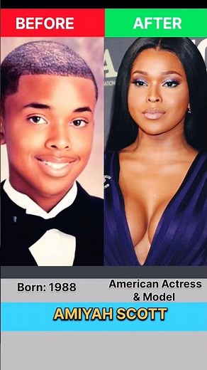 10 Famous Celebrities Who Underwent Gender Transition | Before & After Transformation Part-1