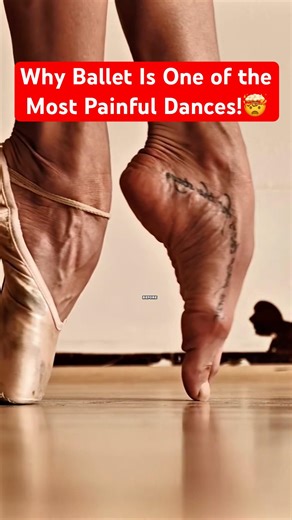 Ballet's Painful Secret Revealed #ballet #pointeshoes #dancerlife
