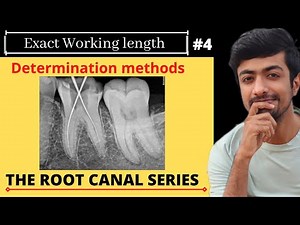 Working length Determination| Vital pulp| Calcified canals|Dental ji|Basic root canal series| Part 4