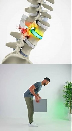 How Bending Damages Your Disc And the Safe Way to Do It #health #motivation #painrehabb