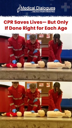 Medical Dialogues on Instagram: "CPR techniques vary by age, and knowing the correct approach is essential during life-threatening emergencies. Proper chest compression depth, hand placement, and breathing methods differ for infants, children, and adults. Acting quickly and calling emergency services immediately can help save lives. Credits: @medicationn3d #CPR #CPRTraining #LifeSavingSkills #EmergencyCare #FirstAid #MedicalAwareness #HealthEducation #PublicHealth #SaveLives #medicaldialogues"