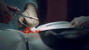 Closeup surgeon hands stitching wound after successful operation in clinic. | Free Stock Video Footage