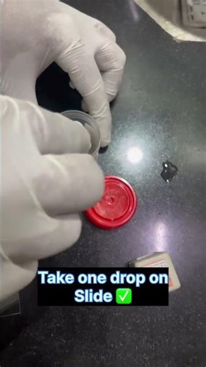 seman analysis 👀🔬 under the microscope 🔬🥼