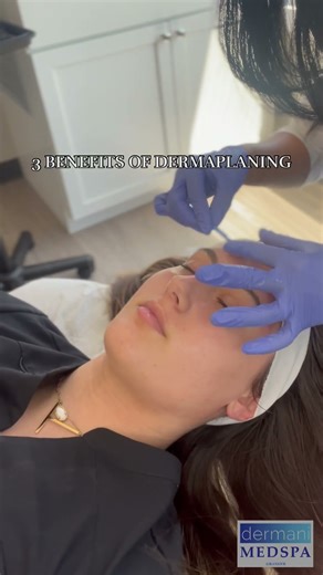 3 benefits of dermaplaning!