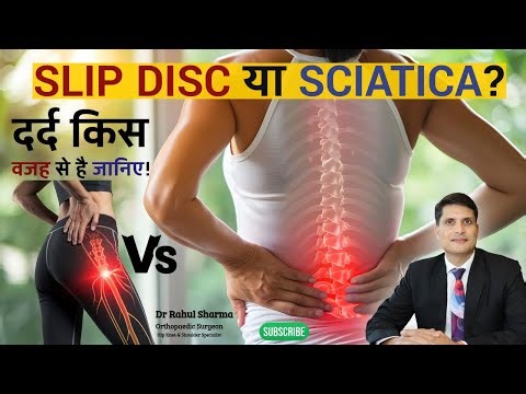 कमर और पैर दर्द: Slip Disc या Sciatica? सही पहचान करें आपका दर्द किस वजह से है?