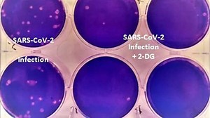 DRDO's 2-DG drug for treating Covid-19 patients launched; to reduce dependence on oxygen