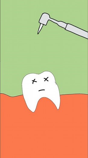 funny tooth cartoon animation #cartoon #animation #tooth #funny