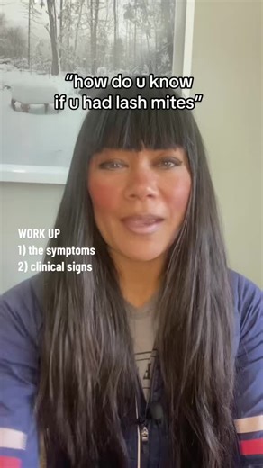 Understanding Demodex Mites on Eyelashes and Symptoms