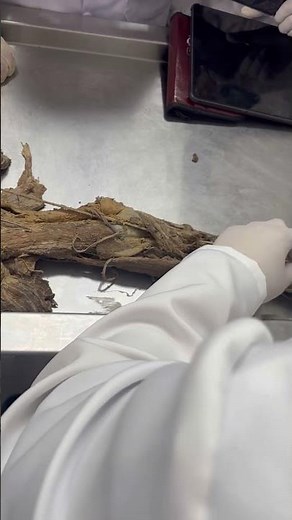 Músculos del antebrazo- Anatomía