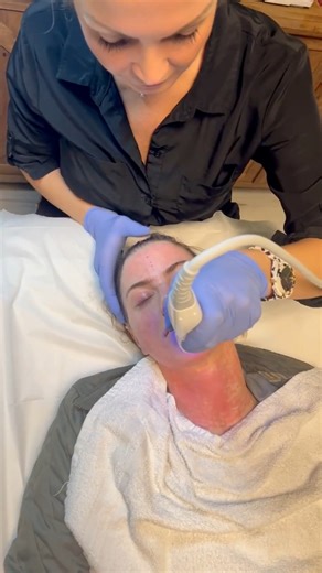 Microneedling creates controlled micro‑channels that spark your skin’s natural repair process. Over a series, it can refine texture, soften the look of pores and fine lines, and improve overall tone. Let’s create a treatment plan to get you results! 📍The Aesthetix Lounge, Lancaster PA | The Aesthetix Lounge